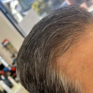 ビフォーアフター / 白髪対策 比較写真